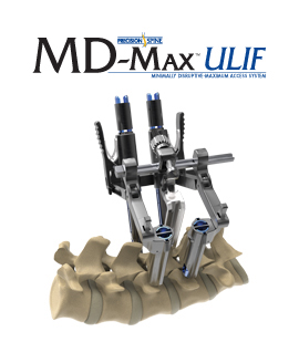 MD-Max™ ULIF Minimally Disruptive-Maximum Access System