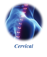 SureLOK™ PC Posterior Cervical System