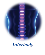 SureLOK™ PC Posterior Cervical System